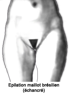 Epilation_maillot_Bresilien_femme.jpg